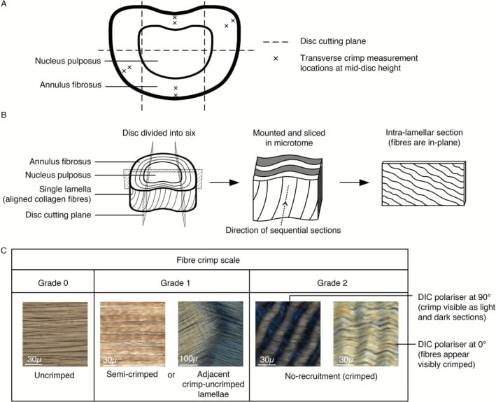 Disc sectioning diagram and microscopy examples grading annulus fibrosus collagen fibre crimp