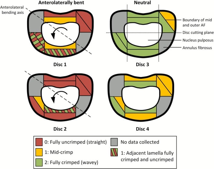 Transverse disc maps of regional annulus fibre crimp in two anterolaterally bent and two neutral discs