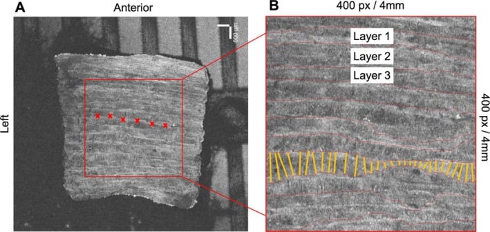 Optical coherence tomography showing individual annulus fibrosus lamellae and their measured boundaries