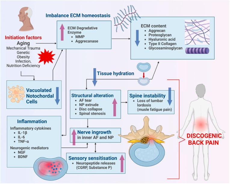 Pathway diagram linking extracellular-matrix imbalance, notochordal-cell loss, nerve ingrowth and structural instability