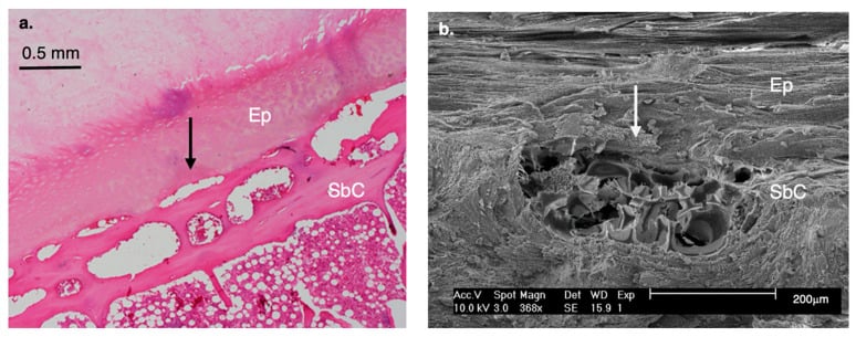 Histology and scanning electron microscopy of the human cartilage endplate and subchondral bone interface