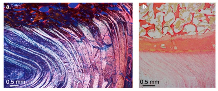 Two-panel histology of the annulus fibrosus: curved collagen lamellae under polarised light, and a stained section with bone above lamellar tissue