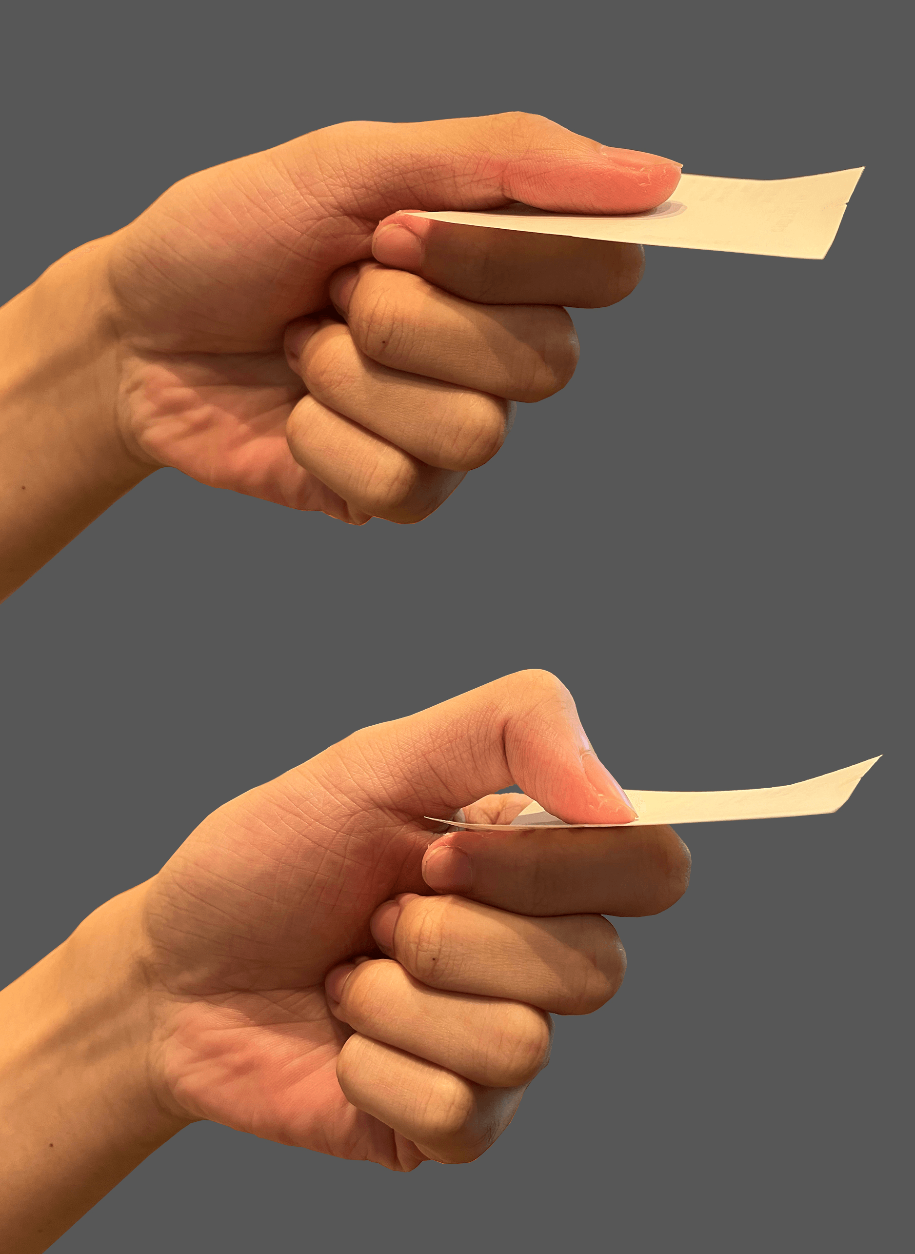 Negative and positive Froment sign during key pinch