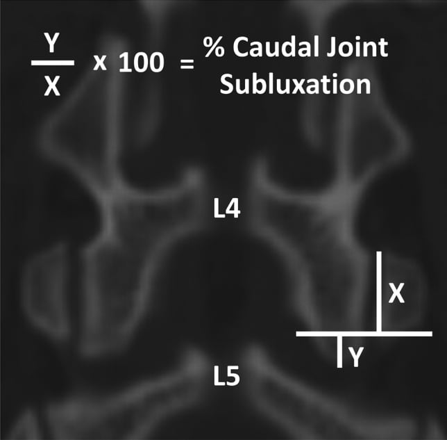 Lateral image showing measurement of percentage caudal joint subluxation as Y divided by X multiplied by one hundred at the L4-L5 facet