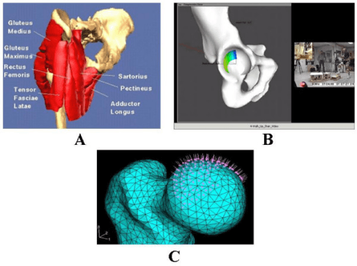 Virtual Interactive Musculoskeletal System (VIMS) models of hip biomechanics