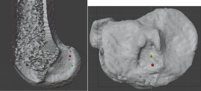 Three-dimensional femoral and tibial attachment regions of the ACL anteromedial and posterolateral bundles