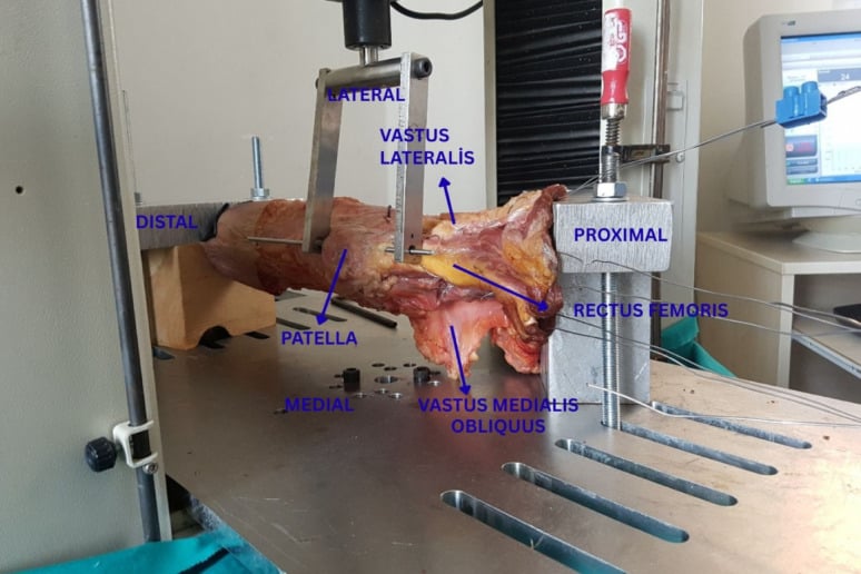 Cadaveric patellofemoral biomechanical test setup with simulated vastus and rectus femoris force vectors