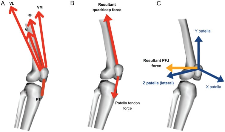 Three-dimensional patellofemoral model showing quadriceps, patellar tendon and resultant joint-force vectors