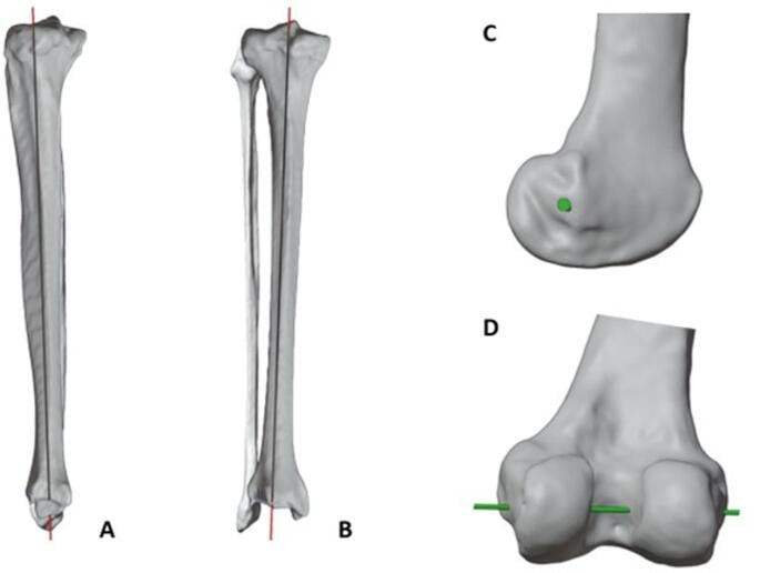 Three-dimensional illustration of tibial and femoral rotation axes responsible for the screw-home mechanism