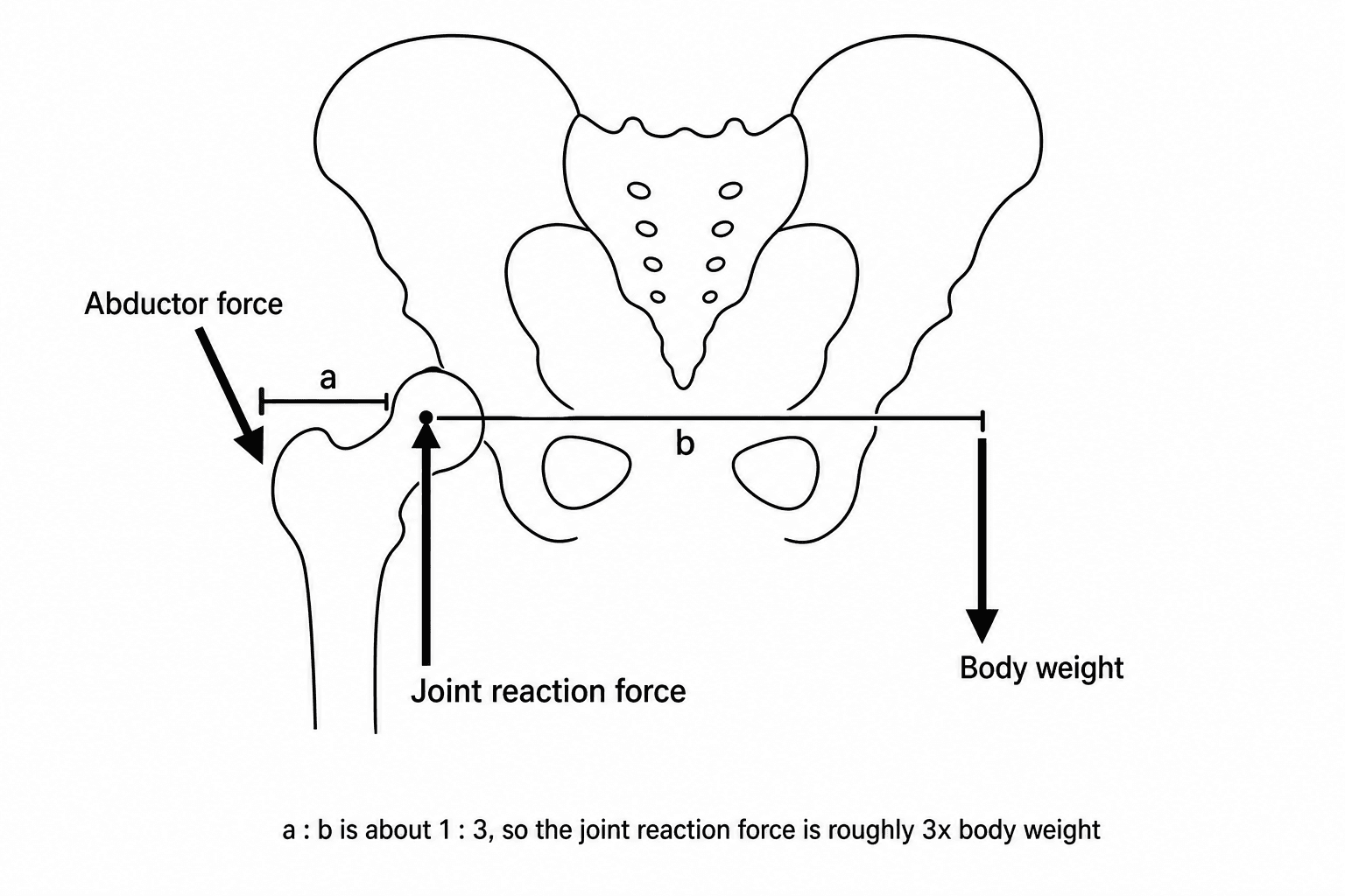 Free-body diagram of the hip in single-leg stance showing the abductor and body-weight lever arms.