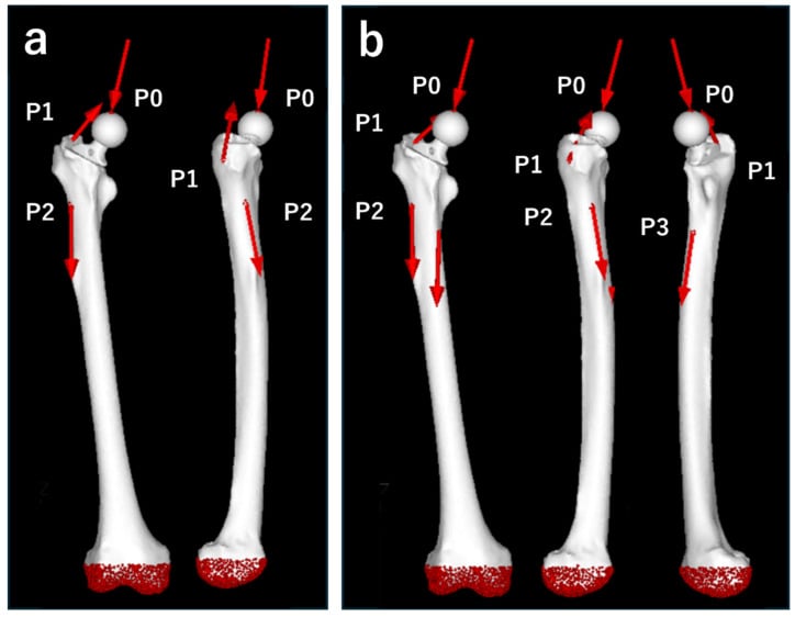 Finite-element femur diagrams marking hip contact, abductor and vastus lateralis load points for walking and stair climbing