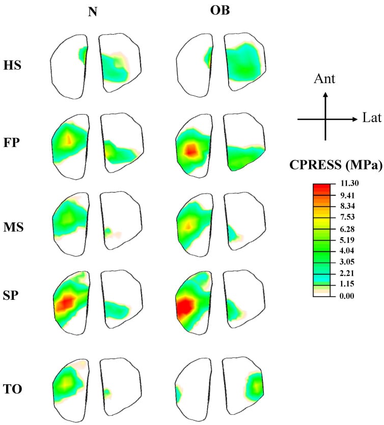 Colour maps of tibial articular contact stress through stance in normal-weight and obese models