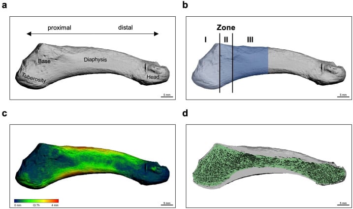 High-resolution peripheral quantitative CT of the fifth metatarsal with the three Lawrence-Botte zones and bone-density mapping