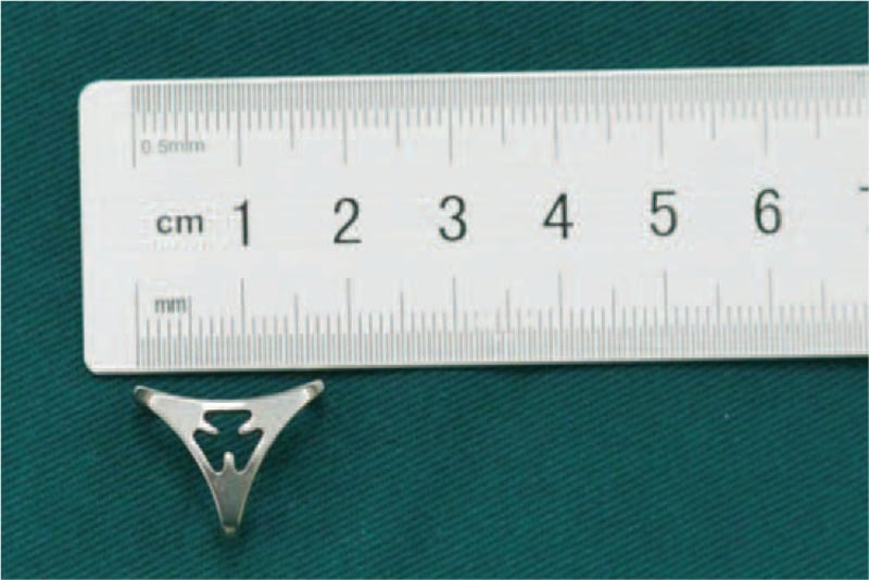 Nickel-titanium STT arthrodesis concentrator beside a centimetre ruler