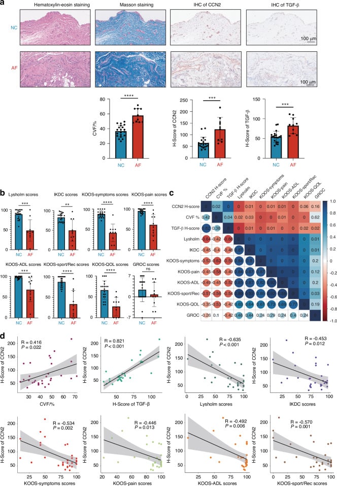 Histological comparison of normal and arthrofibrotic knee synovium with collagen and profibrotic marker staining