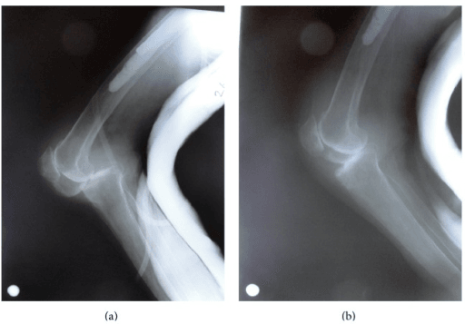 Two-panel lateral knee X-ray showing posterior knee dislocation before and after reduction