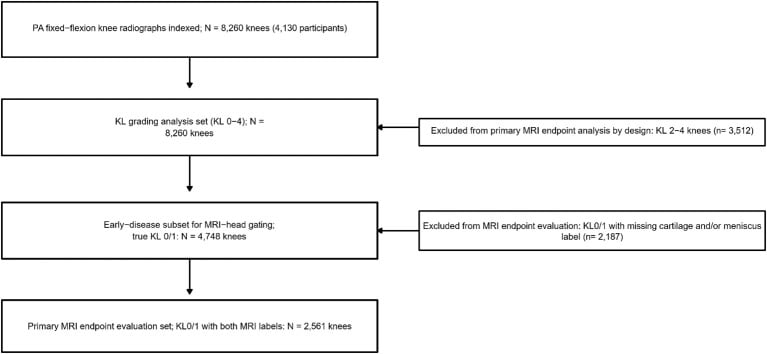 Weightbearing AP knee radiograph series illustrating Kellgren-Lawrence grading scale