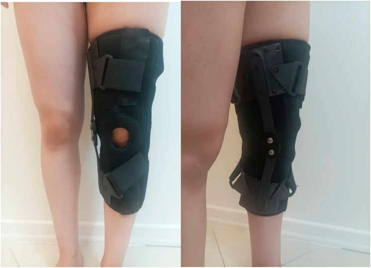 3D motion capture gait analysis setup for measuring ground reaction forces in knee osteoarthritis