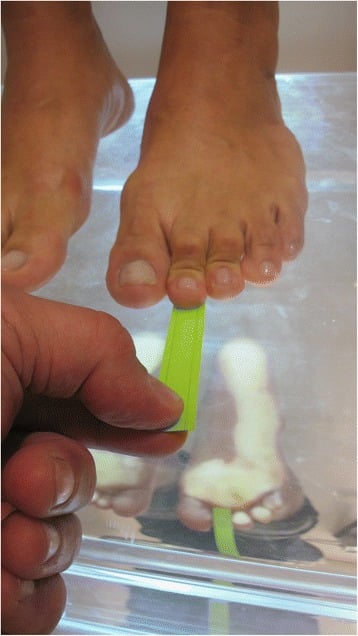 Paper pull-out test: the patient stands on a transparent platform while the examiner pulls a green paper strip from beneath a lesser toe.