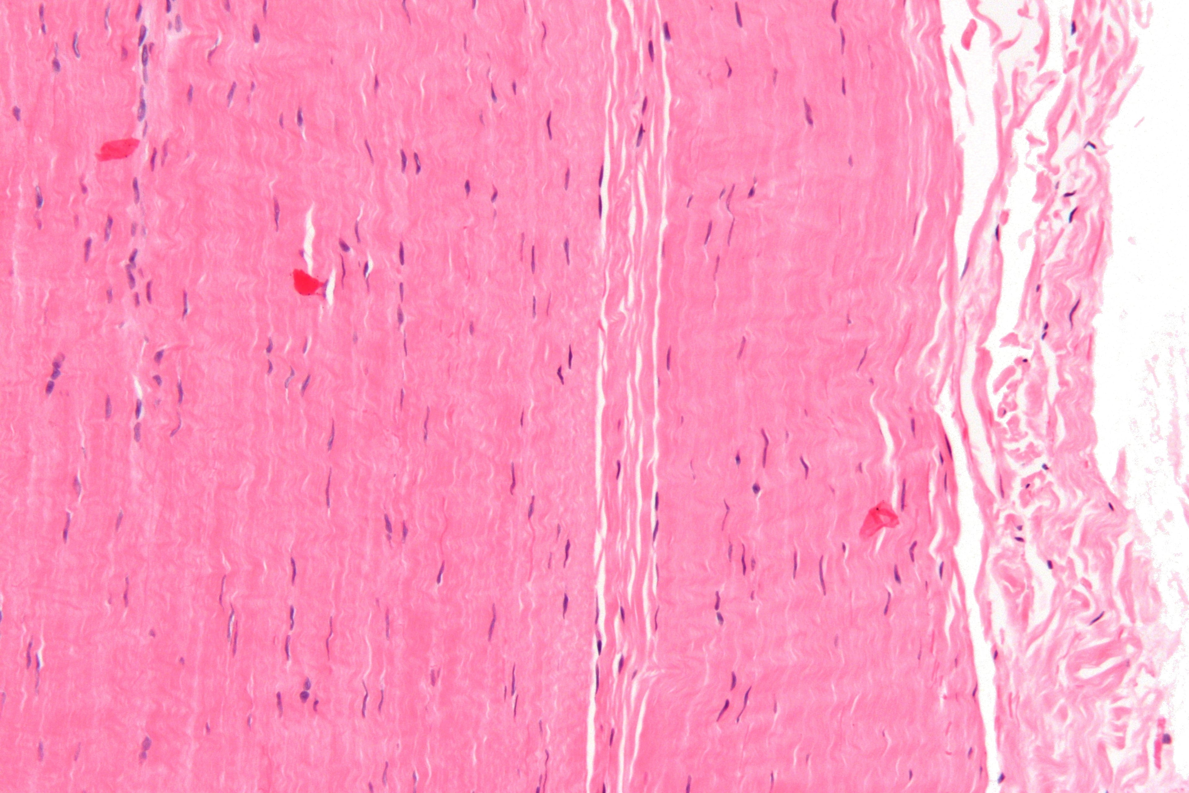 High-magnification histology of dense regular collagenous connective tissue.