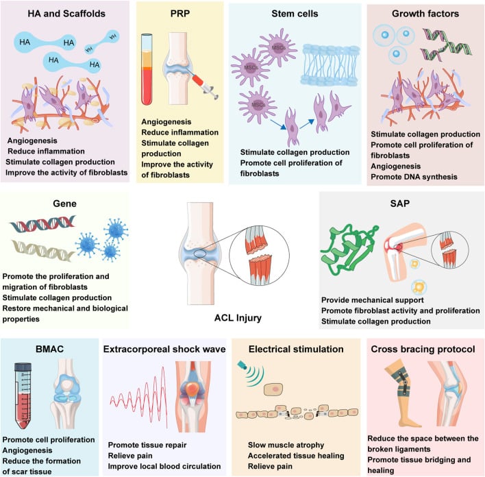 Overview of biotherapeutic and mechanical strategies for ACL and ligament healing