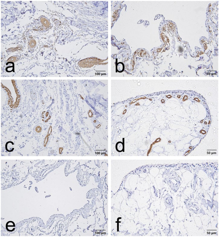 CD34 alpha-SMA and VEGF immunohistochemistry of the proximal ACL epiligament