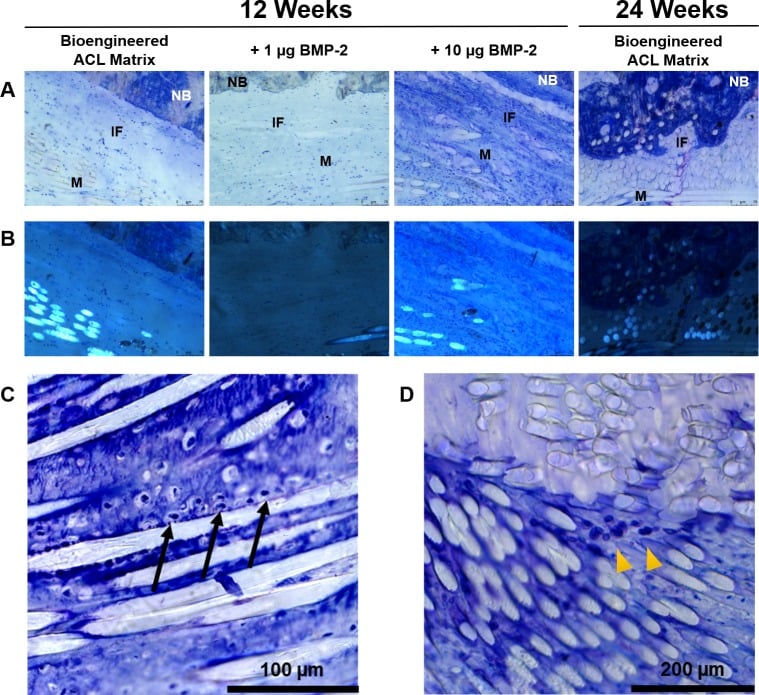 Toluidine-blue and polarised histology of an ACL graft-to-bone tunnel interface at 12 and 24 weeks
