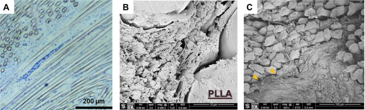 Light and scanning microscopy showing aligned and disorganised tissue within an ACL bone tunnel