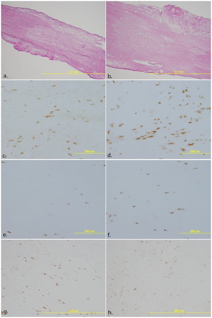 Histology and immunohistochemistry of a healing medial collateral ligament showing granulation tissue, macrophages and proliferating cells