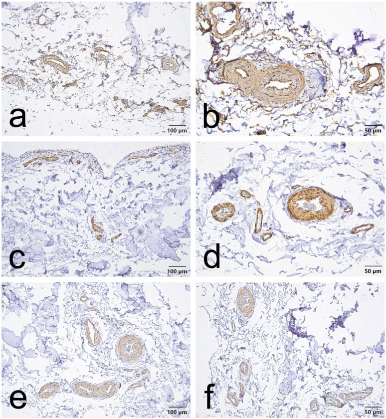CD34 alpha-SMA and VEGF immunohistochemistry of the proximal MCL epiligament