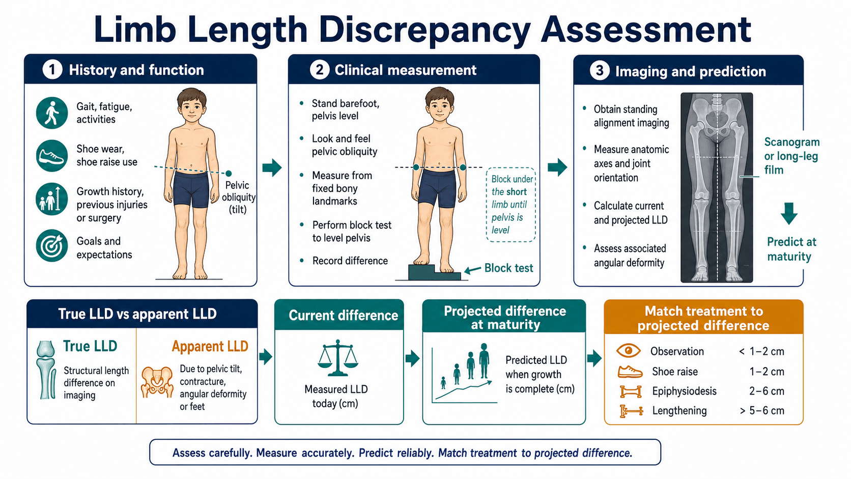 Limb length discrepancy assessment and treatment planning diagram