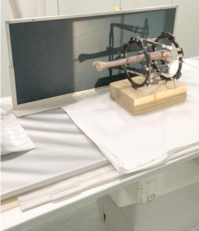 Taylor Spatial Frame mounted on a tibial model positioned for calibrated orthogonal radiographs