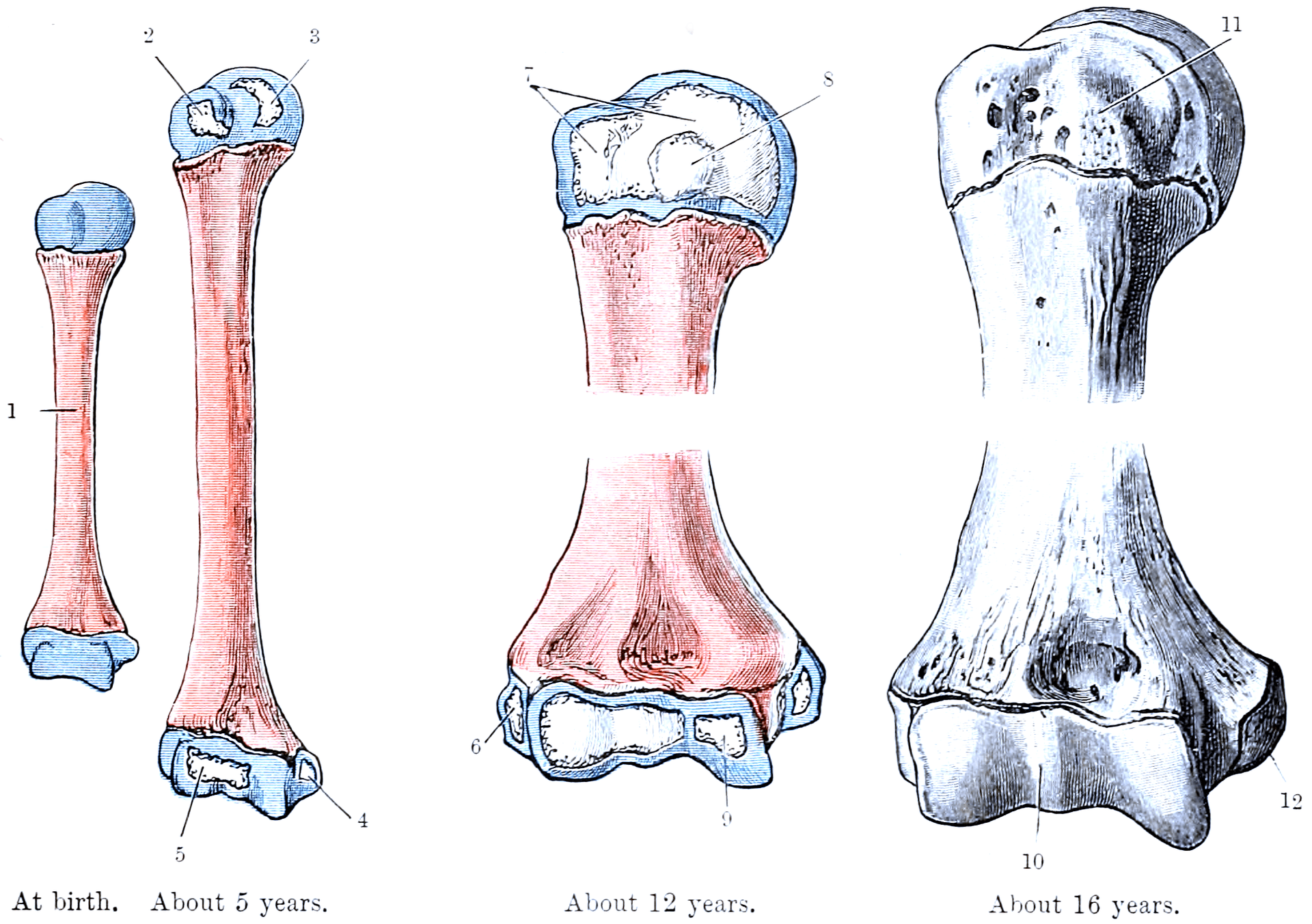 Ossification of the humerus from birth to about 16 years showing the proximal humeral physis
