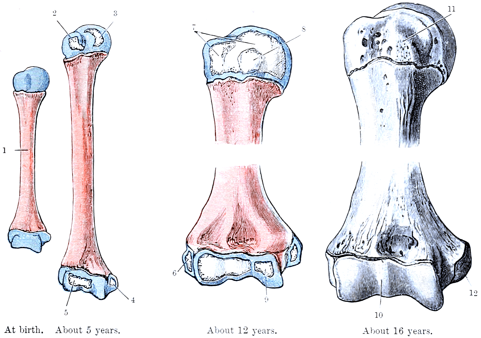 Ossification of the humerus from birth to about 16 years showing the proximal humeral physis