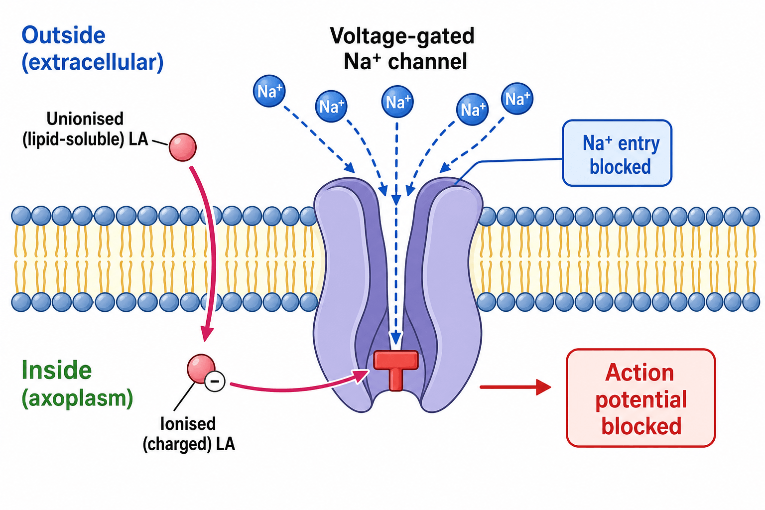 Schematic of local anaesthetic action: the unionised drug crosses the nerve membrane and the ionised form blocks the voltage-gated sodium channel from inside, blocking the action potential.