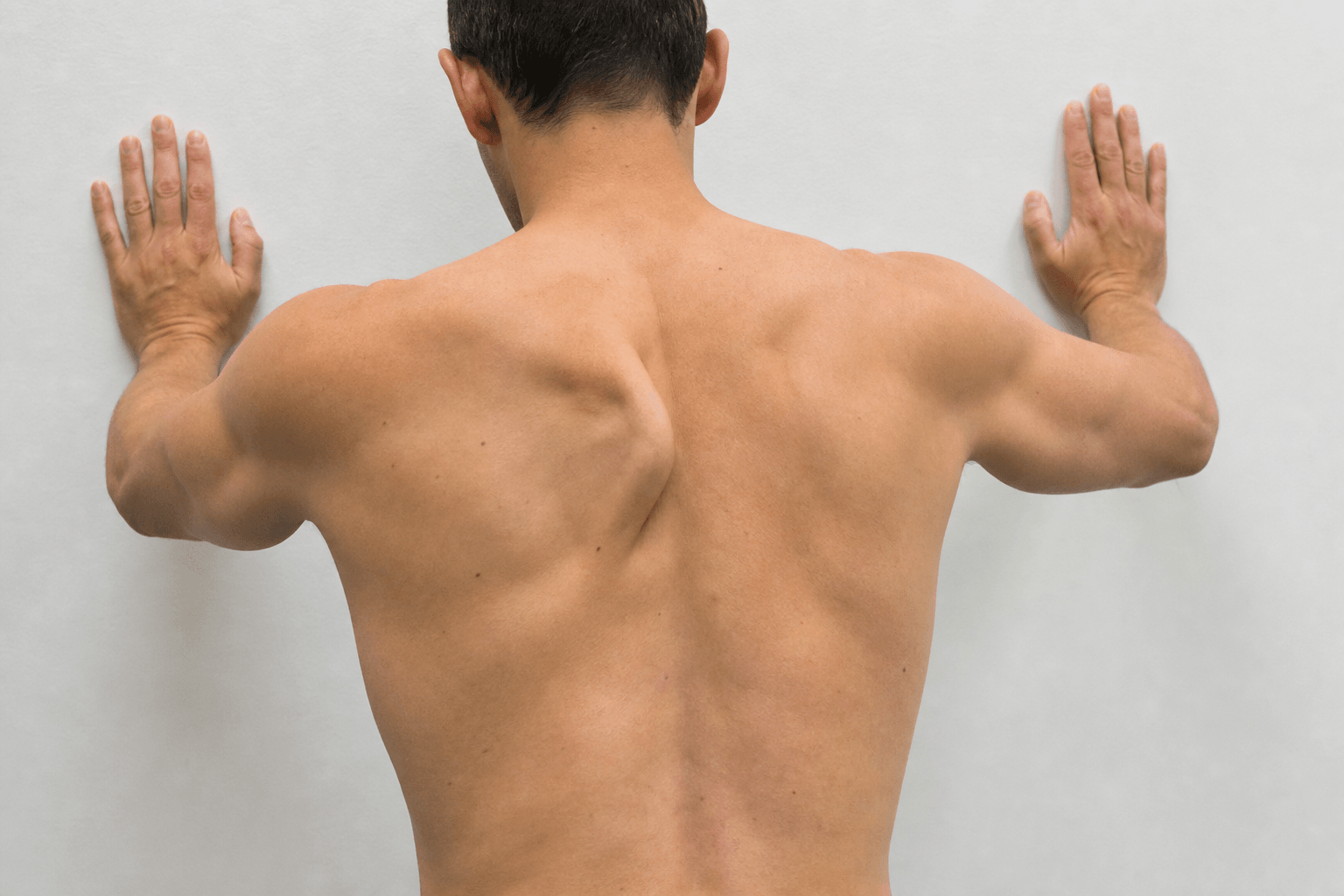 Clinical photograph of a patient performing a wall push-up, the provocation position used to elicit medial scapular winging.