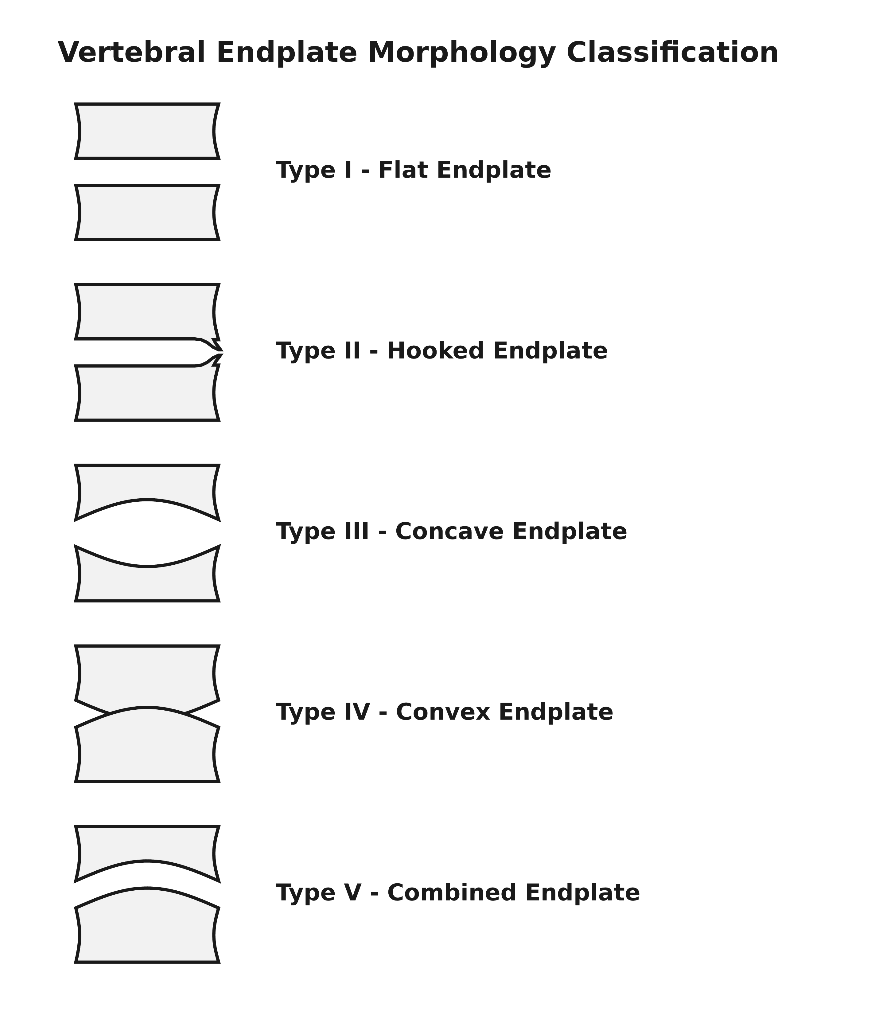 Classification of lumbar vertebral endplate morphology - flat, hooked, concave, convex and combined types - each shown as a schematic line drawing of adjacent vertebral bodies.