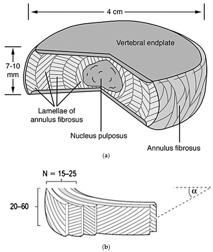 Anatomical illustration of intervertebral disc structure showing nucleus pulposus, annulus fibrosus, and vertebral endplates