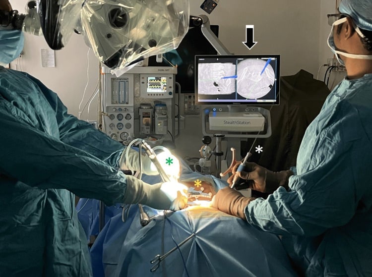 Operating-room setup for a fully navigated minimally invasive TLIF through a tubular retractor