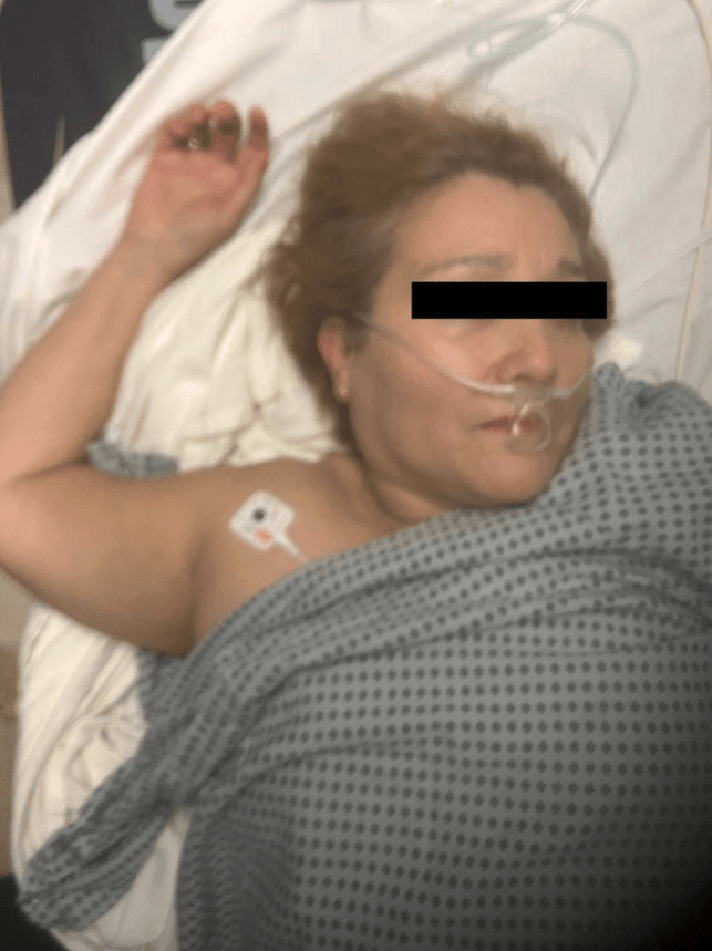 Clinical photograph of a patient with luxatio erecta showing the arm locked in hyperabduction above the head