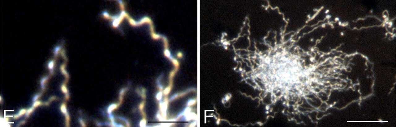 Dark-field microscopy in two panels, E and F, each with a scale bar: slender helical Borrelia burgdorferi spirochaetes in E and a dense colony aggregate in F.