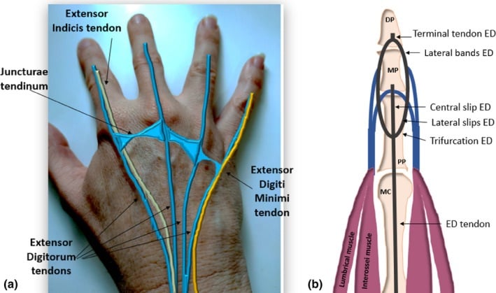 Surface anatomy and schematic of the finger extensor apparatus from extensor digitorum to the central slip lateral bands and terminal tendon