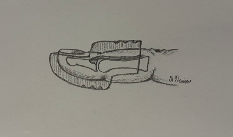 Sagittal drawing of a Stack orthosis holding the distal interphalangeal joint in slight extension