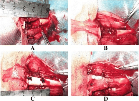 Four intraoperative photographs showing defect preparation, fascial flap, allograft fixation and flap wrapping.