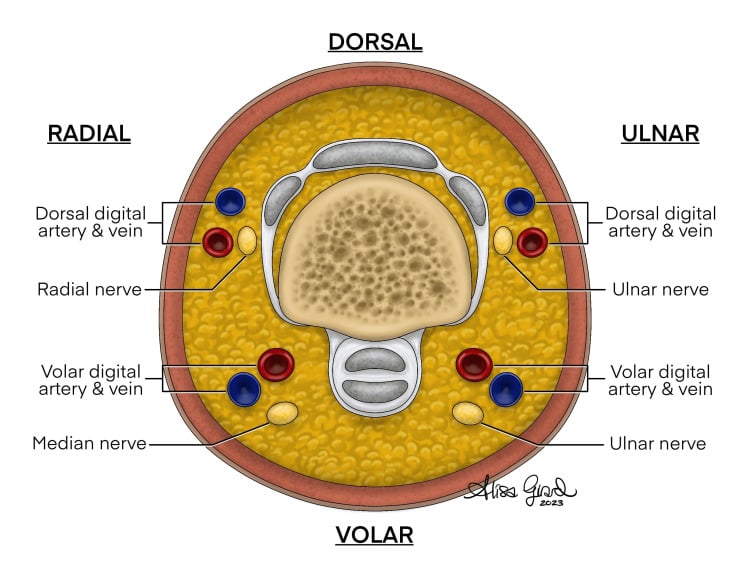 Cross-sectional illustration of a proximal ring finger showing median, ulnar and radial nerves alongside the digital vessels.