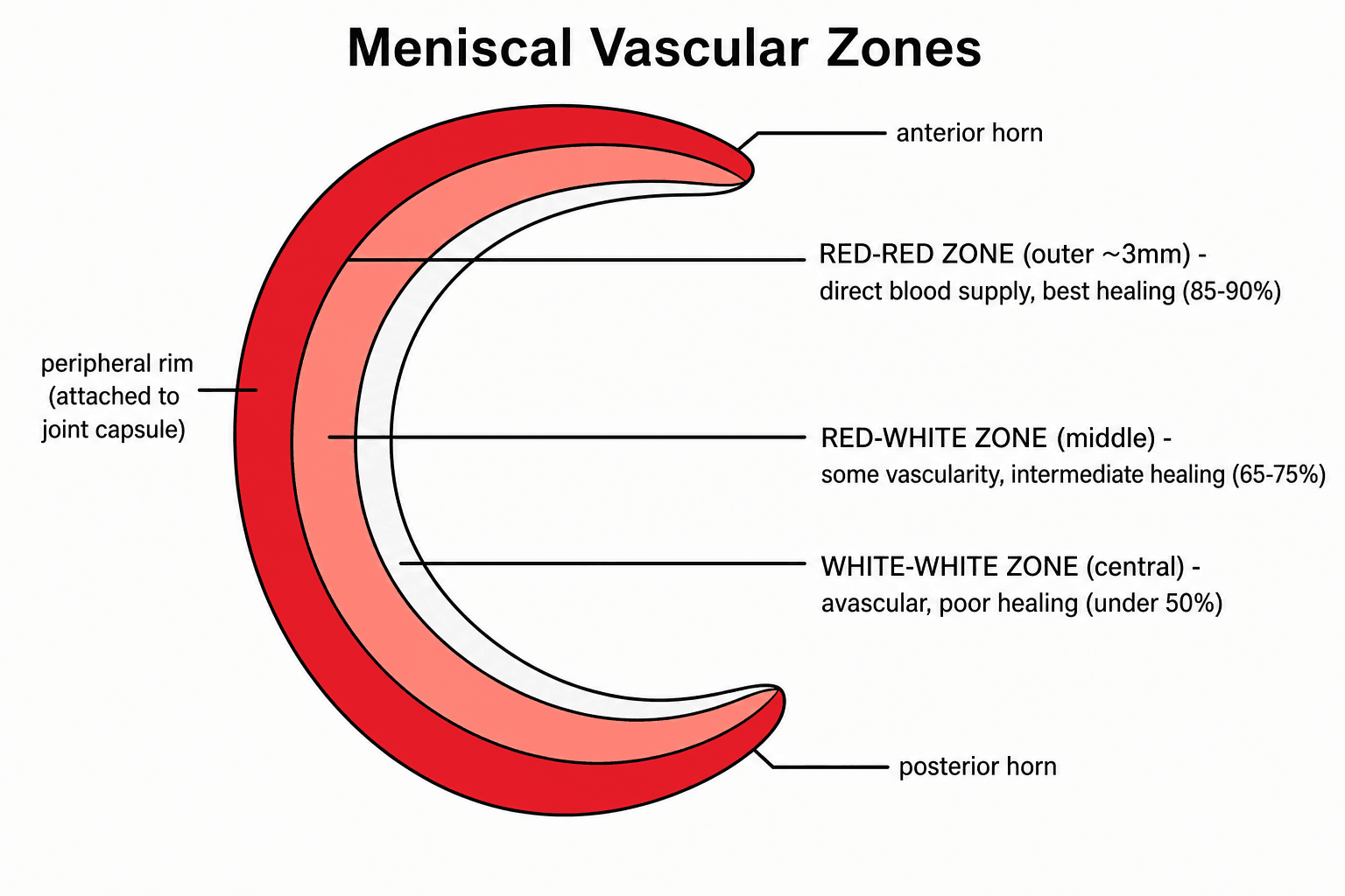 Schematic of the meniscus showing the red-red, red-white and white-white vascular zones