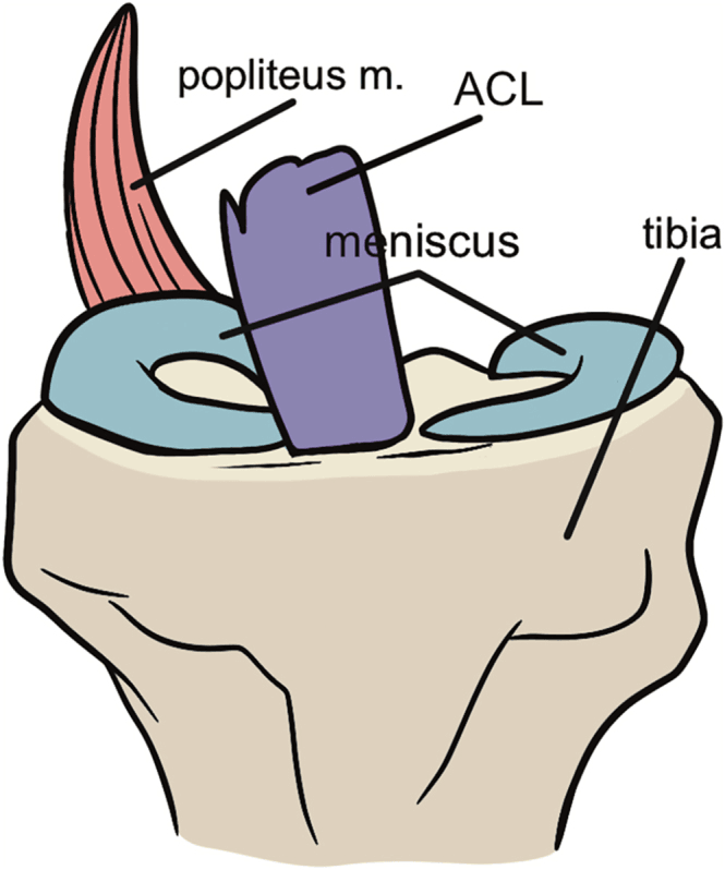 Labelled drawing of the menisci, ACL and popliteus muscle on the tibial plateau