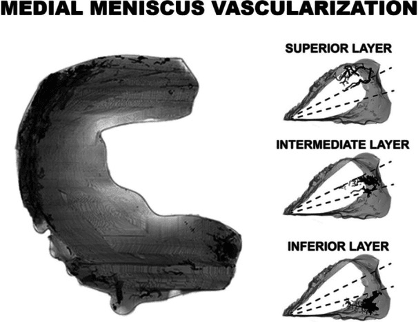 Micro-CT of the medial meniscus with cross-sections of the superior, intermediate and inferior layers showing peripheral vessels