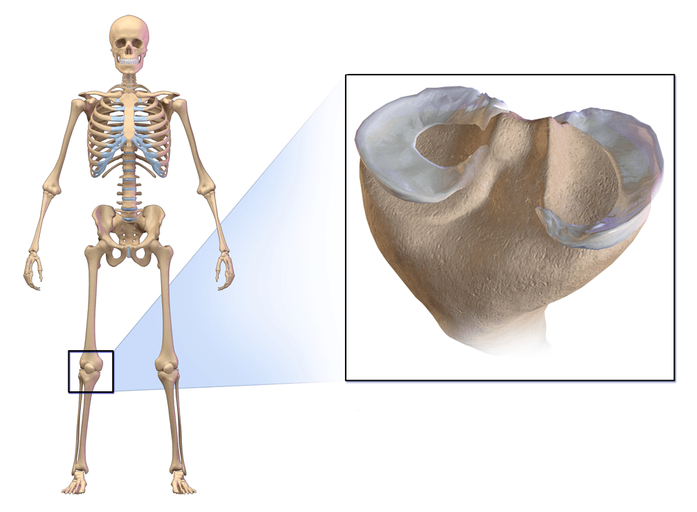 Illustration of both menisci seated on the tibial plateau, shown in an inset from a whole-skeleton view