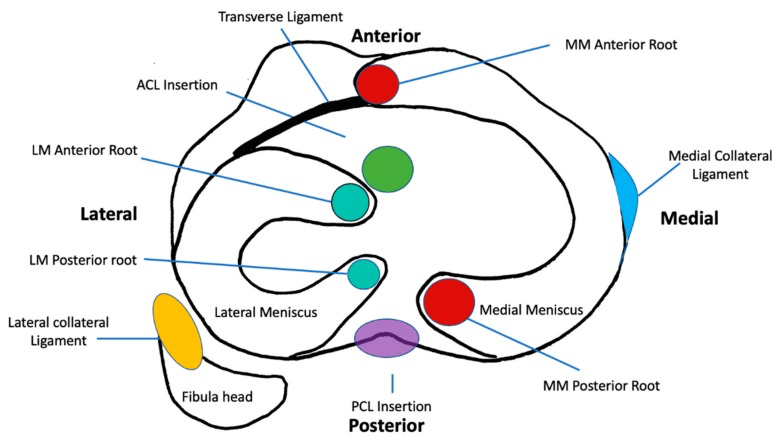 Axial diagram of the medial and lateral meniscal roots and their relations to the ACL and PCL insertions and collateral ligaments
